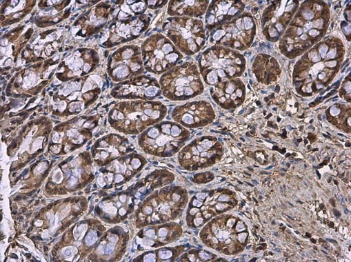 hypoxanthine phosphoribosyltransferase 1 Antibody