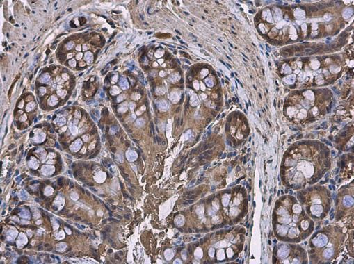 hypoxanthine phosphoribosyltransferase 1 Antibody