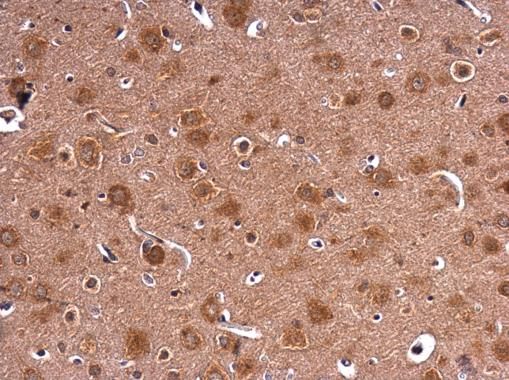 hypoxanthine phosphoribosyltransferase 1 Antibody