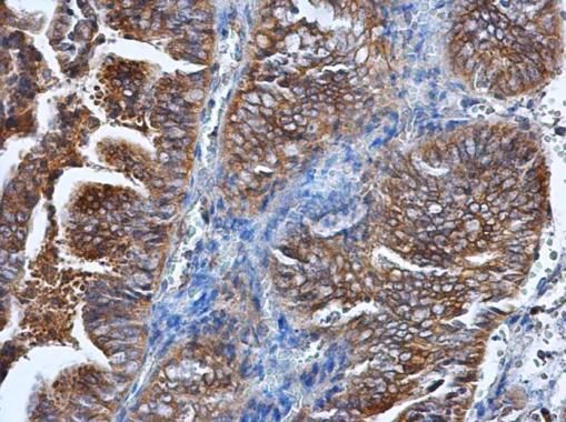 hypoxanthine phosphoribosyltransferase 1 Antibody