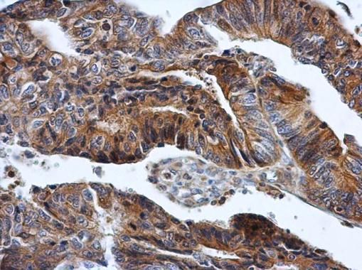 hypoxanthine phosphoribosyltransferase 1 Antibody