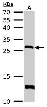 hypoxanthine phosphoribosyltransferase 1 Antibody
