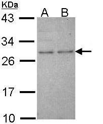 hypoxanthine phosphoribosyltransferase 1 Antibody