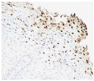 Mouse HPV-16 E6, clone HPV-13E2 (Monoclonal) Antibody