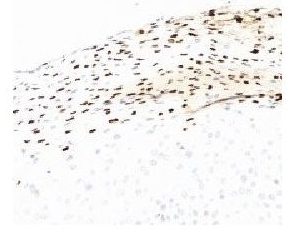 Mouse HPV-16 E6, clone HPV-4B12 (Monoclonal) Antibody