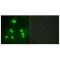HR Antibody