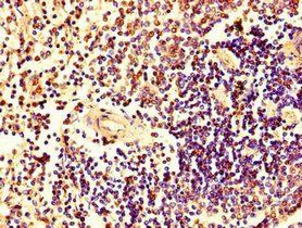 HRAS Antibody