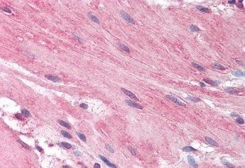 Histamine Receptor H1 (C Term) Antibody