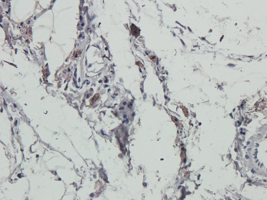 HRH4 Rabbit Polyclonal Antibody