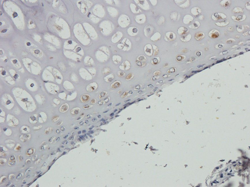 HRH4 Rabbit Polyclonal Antibody