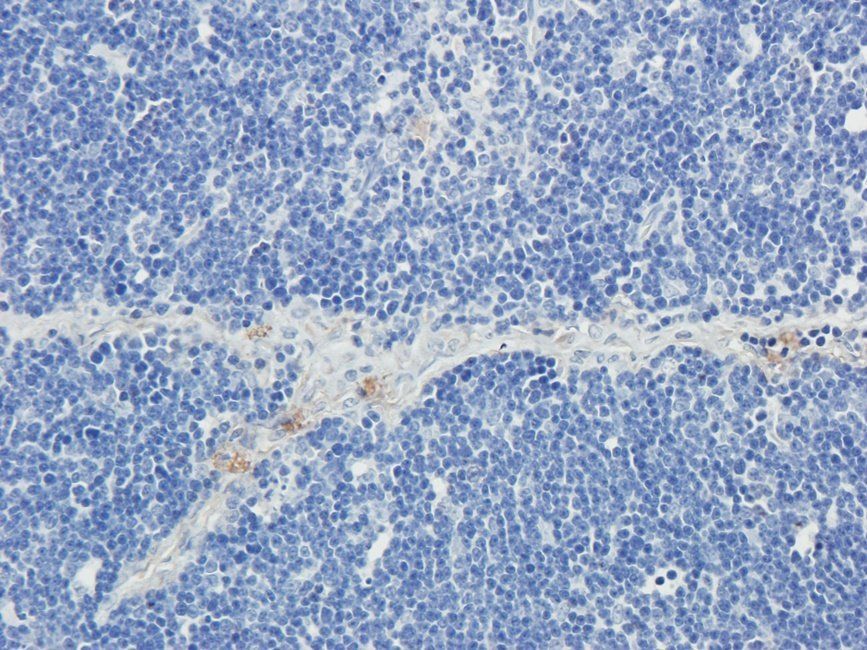 HRH4 Rabbit Polyclonal Antibody