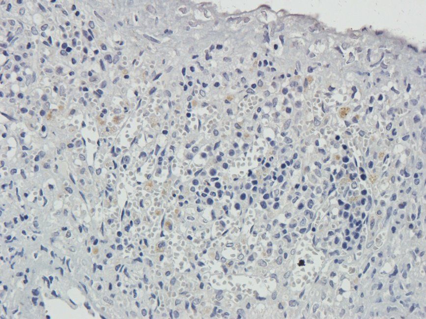 HRH4 Rabbit Polyclonal Antibody