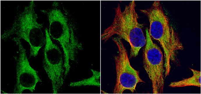 hydroxysteroid 11-beta dehydrogenase 1 Antibody