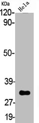 HSD11B1 Antibody
