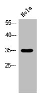 HSD11B1 Antibody