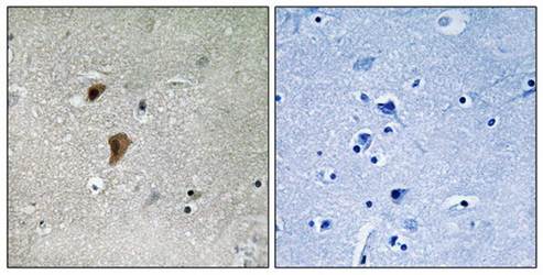 HSF1 (Phospho-Thr142) Antibody