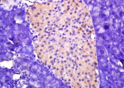 Phospho-HSL (Ser660) Rabbit Polyclonal Antibody