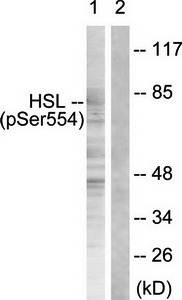 HSL (Phospho-Ser855/554) Antibody