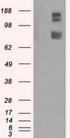 HSP27 Antibody