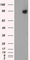 HSP27 Antibody