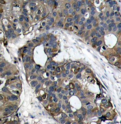 HSP27 (Ab-82) Antibody