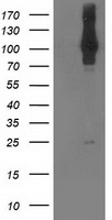 DNAJB1 Antibody