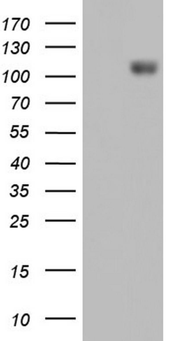 Hsp60 Antibody