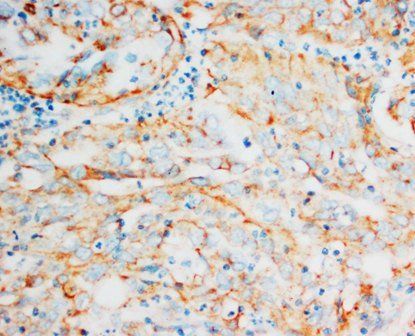 HSP60/HSPD1 Rabbit Polyclonal Antibody