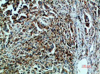 HSPA5 Antibody