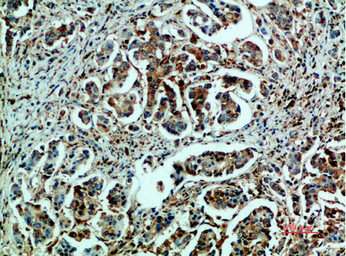 HSPA5 Antibody