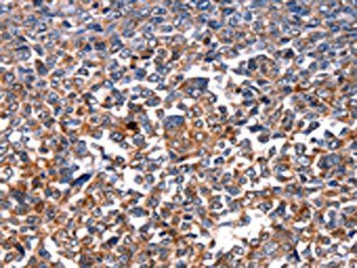 HSPD1 Antibody