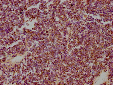 HSPD1 Antibody