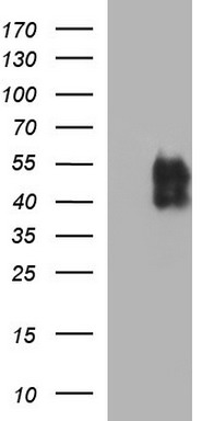 TRMT2A Antibody