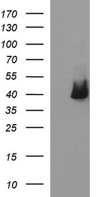 TRMT2A Antibody