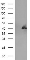 TRMT2A Antibody