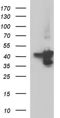 TRMT2A Antibody