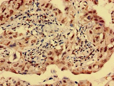 HTR1E Antibody