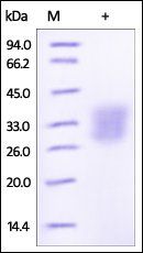 Human Angiopoietin-like 3 Protein, His Tag