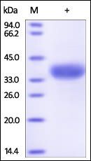 Human Angiopoietin-like 4 Protein, His Tag