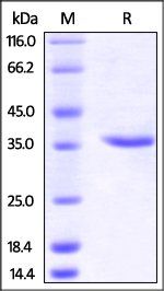 Human Carbonic Anhydrase IX / CA9 (138-414) Protein