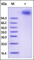 Human VCAM-1 Protein, His Tag