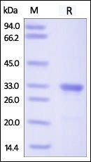 Human Galectin-3 Protein, His Tag