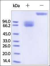 Human Growth Hormone R Protein, Fc Tag