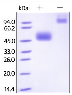 Human NKp30 Protein, Fc Tag