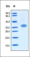 Human Oncostatin M Protein