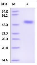 Human Serpin F1 Protein, His Tag