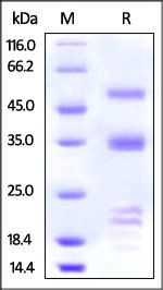 Human PLAU Protein, His Tag