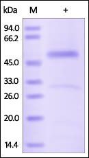 Human Serpin H1 Protein, His Tag