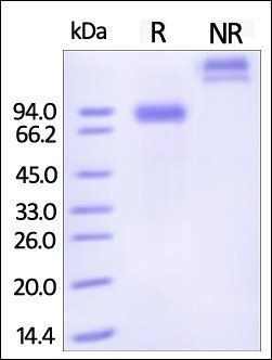 Human Siglec-6 Protein, Fc Tag