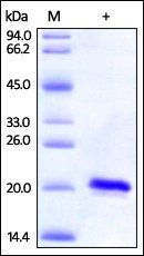 Human SOD1 Protein, His Tag